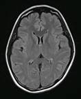 MRI3